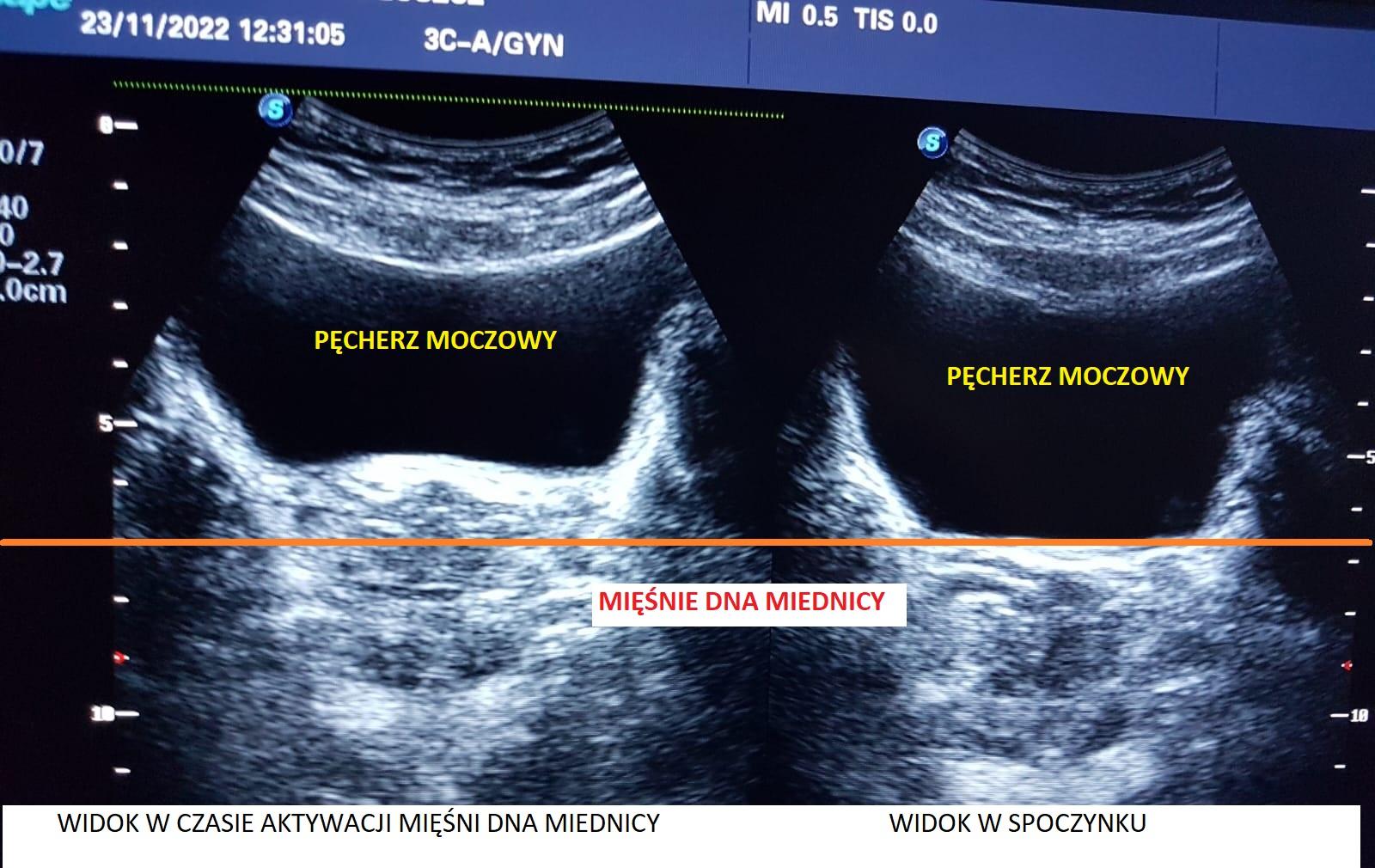 Obraz zawierający tekst, Badanie medyczne, radiologia, Położnicze badanie ultrasonograficzne

Opis wygenerowany automatycznie